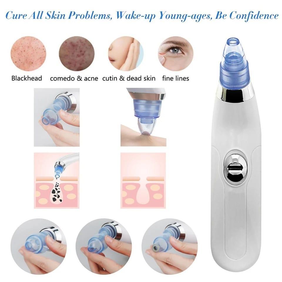 Face Vacuum Suction Blackhead Remover